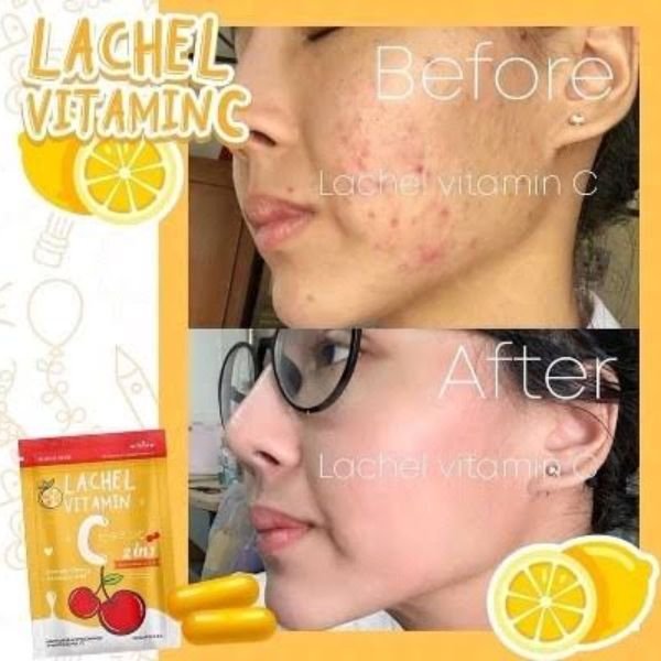 Lachel Vitamin C